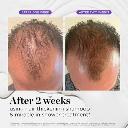 Dr. Groot Miracle in Shower Treatment - product detail image 8